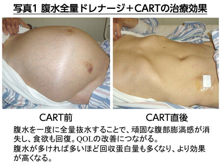 治療効果の画像1