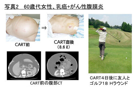 治療効果の画像2